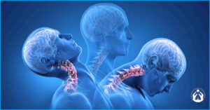 Esguince cervical