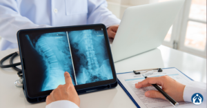 Hernias de disco lumbar
