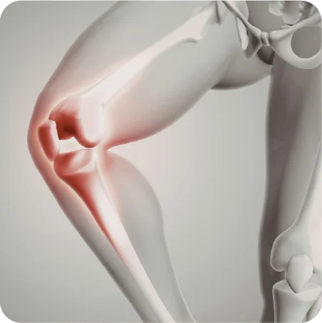 Dolor en ligamentos y articulaciones tratado en Centro Quiropráctico Veracruz