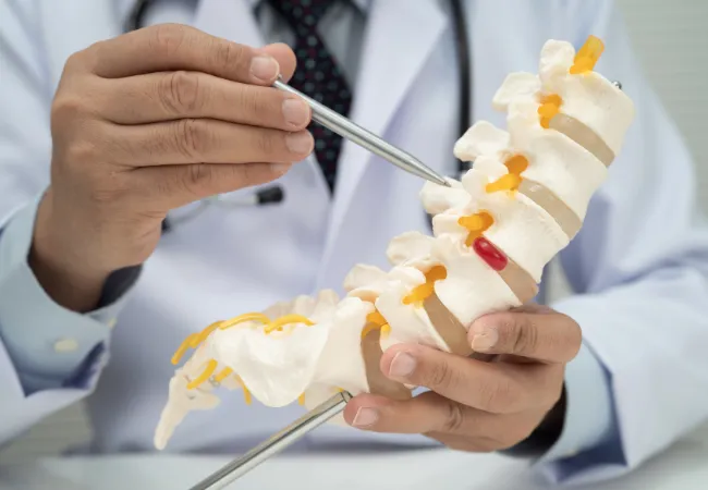 sintomas-de-la-hernia-discal-quiropractico-veracruz